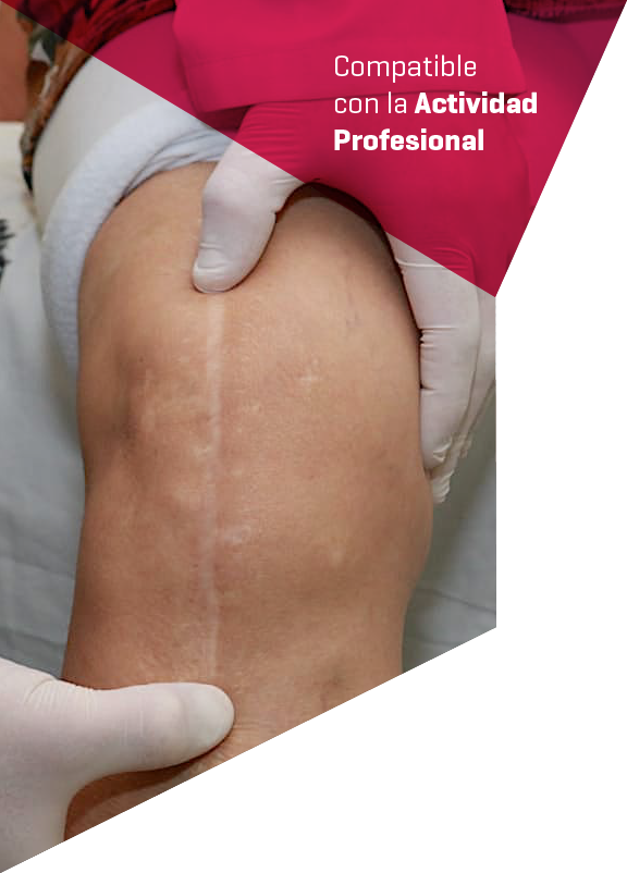 Imagen cabecera curso Artroplastia de Rodilla Curso Artroplastia de Rodilla realizado por nuestros profesores de Alebat Education