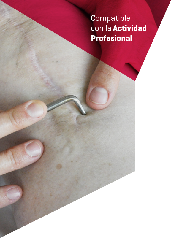 Imagen cabecera curso Lesiones Meniscales y Ligamentosas Curso Lesiones Meniscales y Ligamentosas realizado por nuestros profesores de Alebat Education