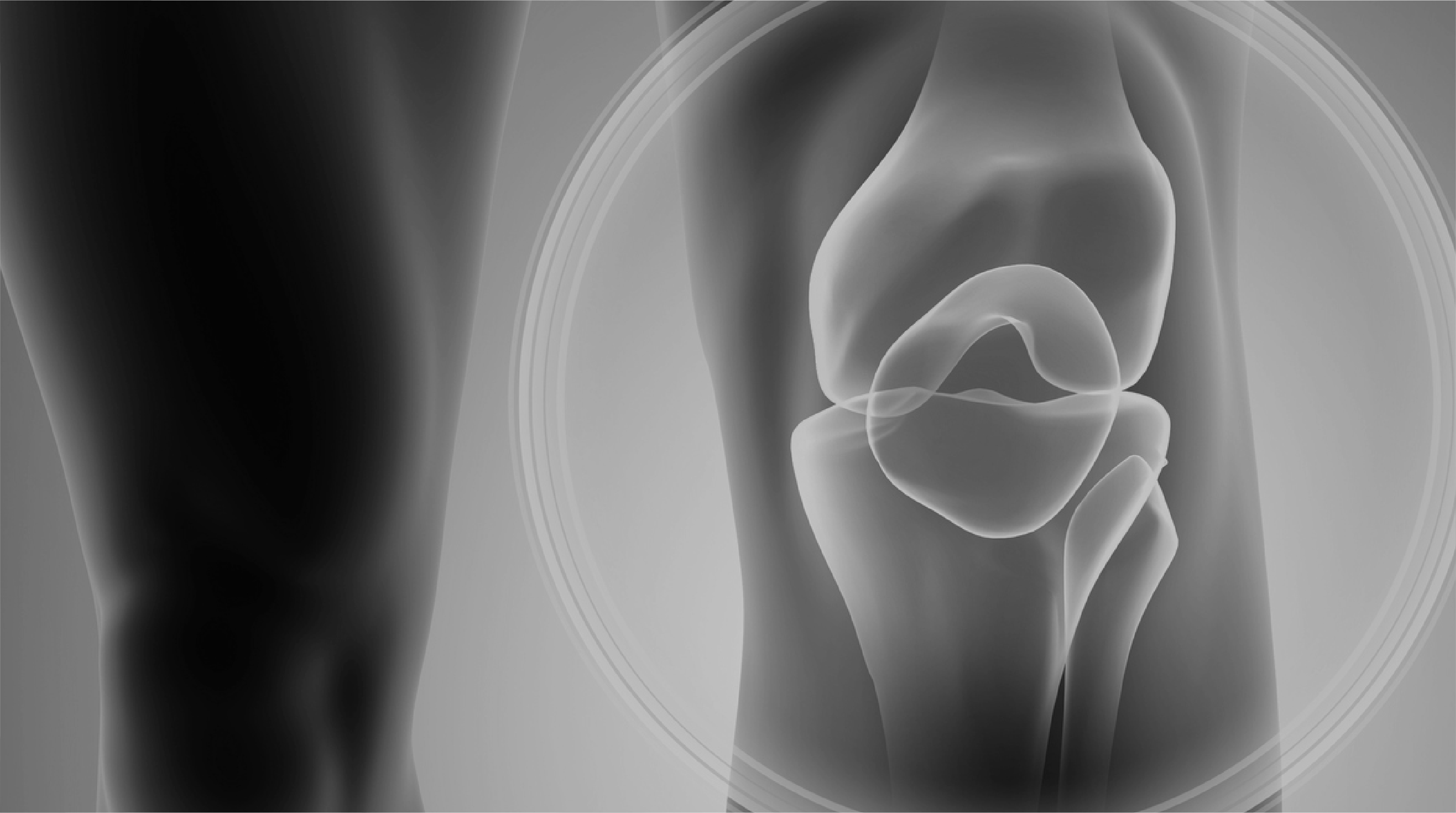 Imagen de curso de salud Anatomía Quirúrgica y Exploración de la Rodilla El curso de salud Anatomía Quirúrgica y Exploración de la Rodilla forma parte de nuestro catálogo de cursos de Alebat Education