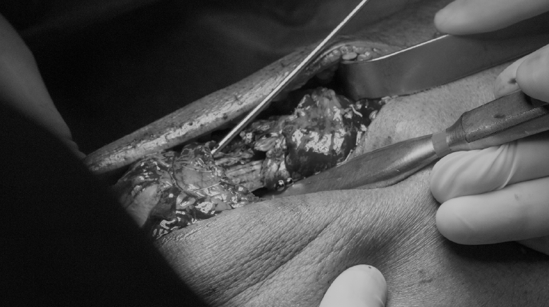 Imagen de curso de salud Prótesis Total de Rodilla Infectada El curso de salud Prótesis Total de Rodilla Infectada forma parte de nuestro catálogo de cursos de Alebat Education