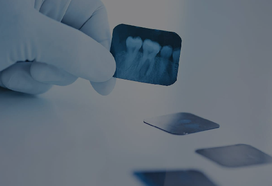 Periodontitis y Diabetes: Amistades Peligrosas
