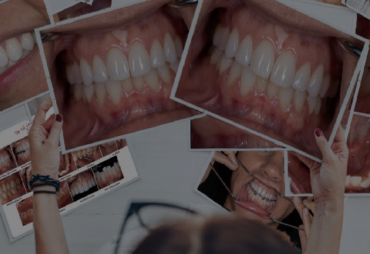 Cómo elegir una cámara intraoral odontológica